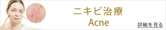 ニキビバナー